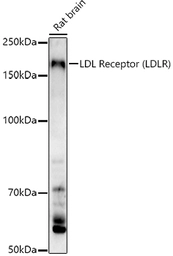Anti-LDL Receptor antibody used in Western Blot (WB). GTX05038