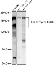 Anti-LDL Receptor antibody used in Western Blot (WB). GTX05038