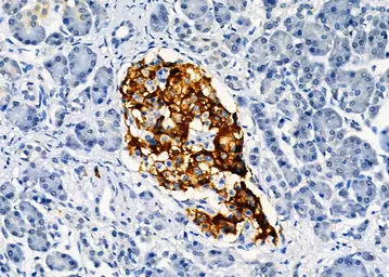 Anti-LYVE1 antibody used in IHC (Paraffin sections) (IHC-P). GTX05039