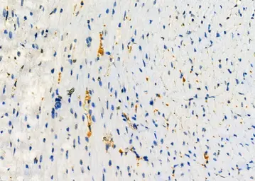 Anti-LYVE1 antibody used in IHC (Paraffin sections) (IHC-P). GTX05039