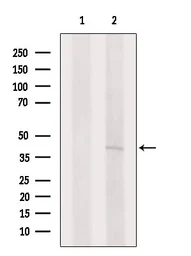 Anti-LYVE1 antibody used in Western Blot (WB). GTX05039