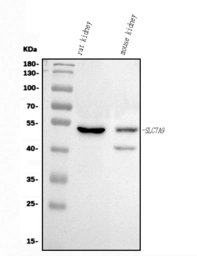Anti-SLC7A9 antibody used in Western Blot (WB). GTX05042