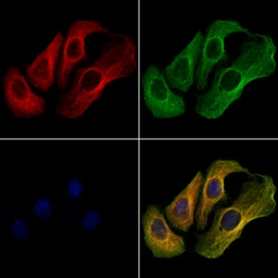 Anti-TRPC3 antibody used in Immunocytochemistry/ Immunofluorescence (ICC/IF). GTX05043