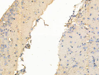 Anti-TRPC3 antibody used in IHC (Paraffin sections) (IHC-P). GTX05043
