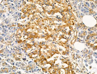 Anti-TRPC3 antibody used in IHC (Paraffin sections) (IHC-P). GTX05043
