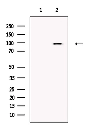 Anti-TRPC3 antibody used in Western Blot (WB). GTX05043
