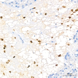 Anti-FGFR1 antibody [ARC53424] used in IHC (Paraffin sections) (IHC-P). GTX05044