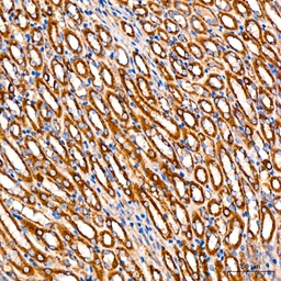 Anti-FGFR1 antibody [ARC53424] used in IHC (Paraffin sections) (IHC-P). GTX05044