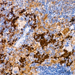 Anti-FGFR1 antibody [ARC53424] used in IHC (Paraffin sections) (IHC-P). GTX05044