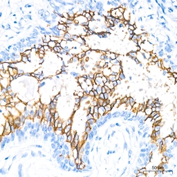 Anti-Aquaporin 4 antibody [ARC54345] used in IHC (Paraffin sections) (IHC-P). GTX05045