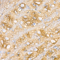Anti-Aquaporin 4 antibody [ARC54345] used in IHC (Paraffin sections) (IHC-P). GTX05045