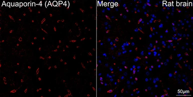 Anti-Aquaporin 4 antibody [ARC54345] used in IHC (Paraffin sections) (IHC-P). GTX05045