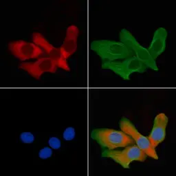 Anti-Aquaporin 6 antibody used in Immunocytochemistry/ Immunofluorescence (ICC/IF). GTX05047