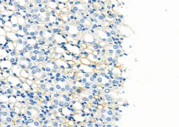 Anti-Aquaporin 6 antibody used in IHC (Paraffin sections) (IHC-P). GTX05047