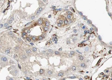 Anti-Aquaporin 6 antibody used in IHC (Paraffin sections) (IHC-P). GTX05047
