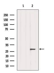 Anti-Aquaporin 6 antibody used in Western Blot (WB). GTX05047