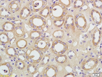 Anti-Aquaporin 5 antibody used in IHC (Paraffin sections) (IHC-P). GTX05048