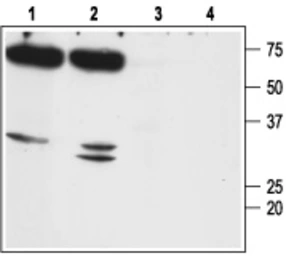 Anti-Aquaporin 7 antibody used in Western Blot (WB). GTX05049