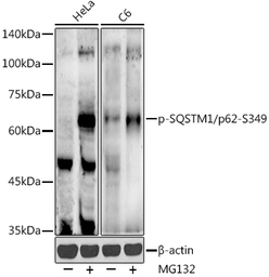 Anti-SQSTM1 / P62 (phospho Ser349) antibody used in Western Blot (WB). GTX05052