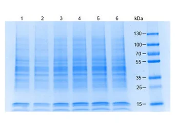 A549 whole cell lysate. GTX05055
