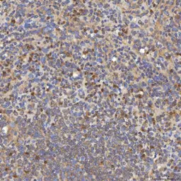Anti-SLC25A10 antibody used in IHC (Paraffin sections) (IHC-P). GTX05059