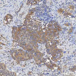Anti-SLC25A10 antibody used in IHC (Paraffin sections) (IHC-P). GTX05059