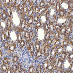 Anti-SLC25A10 antibody used in IHC (Paraffin sections) (IHC-P). GTX05059