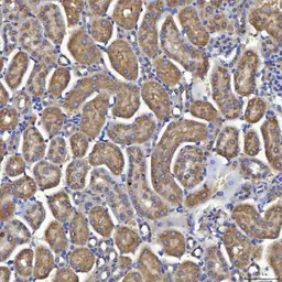 Anti-SLC25A10 antibody used in IHC (Paraffin sections) (IHC-P). GTX05059