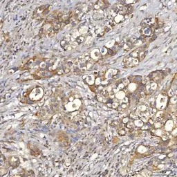 Anti-SLC25A10 antibody used in IHC (Paraffin sections) (IHC-P). GTX05059