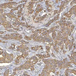 Anti-SLC25A10 antibody used in IHC (Paraffin sections) (IHC-P). GTX05059