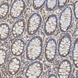 Anti-SLC25A10 antibody used in IHC (Paraffin sections) (IHC-P). GTX05059
