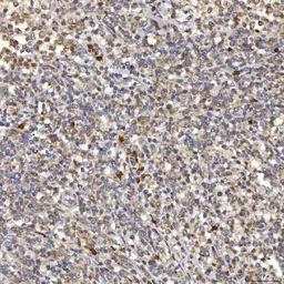 Anti-SLC25A10 antibody used in IHC (Paraffin sections) (IHC-P). GTX05059