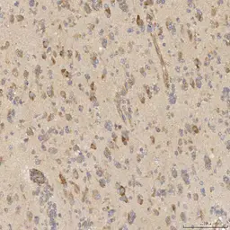 Anti-SLC25A10 antibody used in IHC (Paraffin sections) (IHC-P). GTX05059