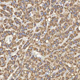 Anti-SLC25A10 antibody used in IHC (Paraffin sections) (IHC-P). GTX05059