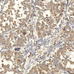 Anti-SLC25A10 antibody used in IHC (Paraffin sections) (IHC-P). GTX05059