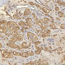 Anti-SLC25A10 antibody used in IHC (Paraffin sections) (IHC-P). GTX05059