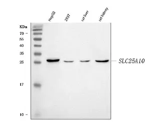 Anti-SLC25A10 antibody used in Western Blot (WB). GTX05059