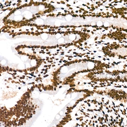 Anti-Pan phosphoserine/threonine antibody [ARC64485] used in IHC (Paraffin sections) (IHC-P). GTX05060