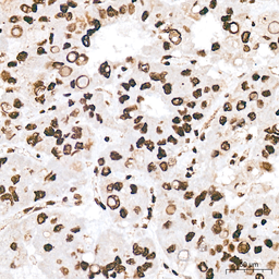 Anti-Pan phosphoserine/threonine antibody [ARC64485] used in IHC (Paraffin sections) (IHC-P). GTX05060