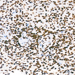Anti-Pan phosphoserine/threonine antibody [ARC64485] used in IHC (Paraffin sections) (IHC-P). GTX05060