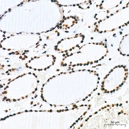 Anti-Pan phosphoserine/threonine antibody [ARC64485] used in IHC (Paraffin sections) (IHC-P). GTX05060