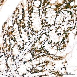 Anti-Pan phosphoserine/threonine antibody [ARC64485] used in IHC (Paraffin sections) (IHC-P). GTX05060