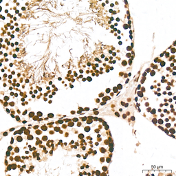 Anti-Pan phosphoserine/threonine antibody [ARC64485] used in IHC (Paraffin sections) (IHC-P). GTX05060
