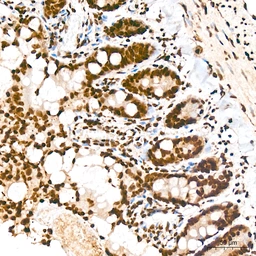 Anti-Pan phosphoserine/threonine antibody [ARC64485] used in IHC (Paraffin sections) (IHC-P). GTX05060