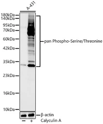 Anti-Pan phosphoserine/threonine antibody [ARC64485] used in Western Blot (WB). GTX05060