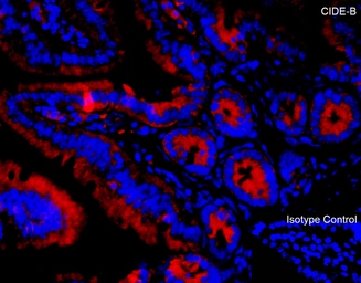Anti-CIDE B antibody used in IHC (Paraffin sections) (IHC-P). GTX05061