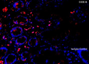 Anti-CIDE B antibody used in IHC (Paraffin sections) (IHC-P). GTX05061