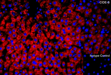 Anti-CIDE B antibody used in IHC (Paraffin sections) (IHC-P). GTX05061
