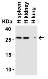 Anti-CIDE B antibody used in Western Blot (WB). GTX05061