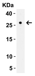 Anti-CIDE B antibody used in Western Blot (WB). GTX05061